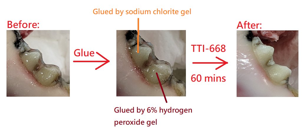 ttitwinkleteeth's tweet photo. Teeth whitening gel has strict legal regulations in the EU, and its hydrogen peroxide concentration cannot exceed 0.1%. Therefore, to have a good whitening effect, you can consider using sodium chlorite gel to achieve good teeth whitening effect!
#teethwhitening #dentist #salon https://t.co/ZqYwZqlcwK