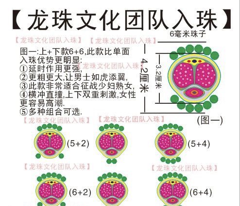 dingjiruzhu's tweet photo. ��珠这个不是你想做多大的就做多大的，是根据龟头大小，包皮长短设计做多大的珠子，一般的珠子是 6 7 8毫米大小的，入珠可以起到增粗延时作用，因为龟头产生快感，挨着龟头在冠状沟做一圈入珠，让珠子减少龟头的快感，我建议做硅胶珠子，因为硅胶珠子是软珠，用着舒服，不会像硬珠硌得慌！ https://t.co/Dt1LhLSqdY