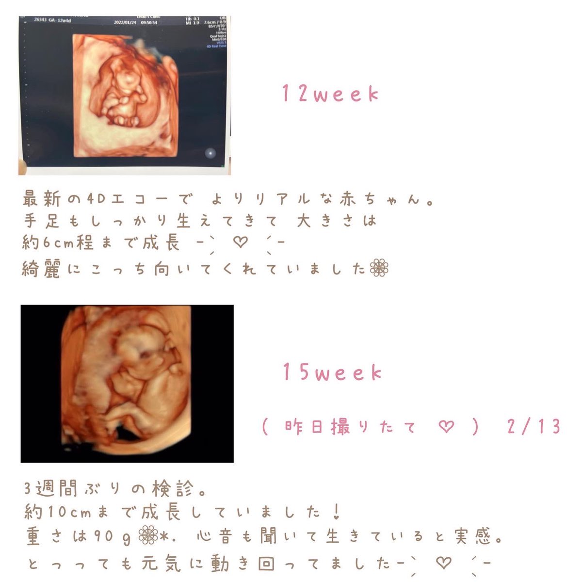 nenelion0808's tweet photo. 私たち2人の間に小さくて愛おしい
大切な命がお腹の中に来てくれました

1年前の2月14日バレンタインにプロポーズしてくれた大切な記念日にインスタでも報告させていただきました💌

今年で付き合って10年目を迎える節目に
家族が増える幸せでいっぱいです。
あと2日で妊娠5ヶ月の安定期に入ります🌷︎ https://t.co/9VHEwPT6fE