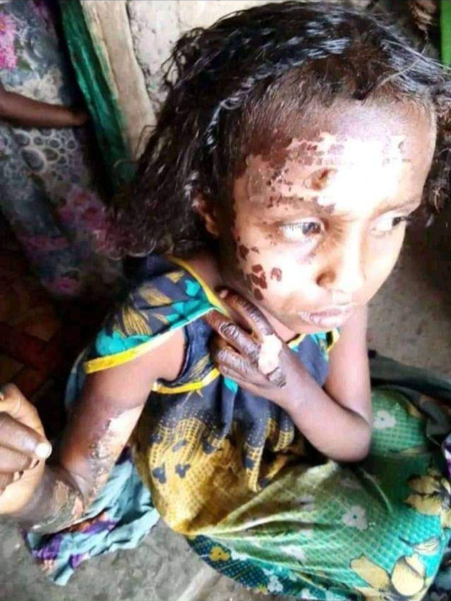qusbamaqar's tweet photo. Pain...
Agony , suffering!
 Why #Goe failed to protect #Afars What is going on behind the curtain?? #AfarIsBleeding @AbiyAhmedAli @DemekeHasen https://t.co/JWiveuQzrj