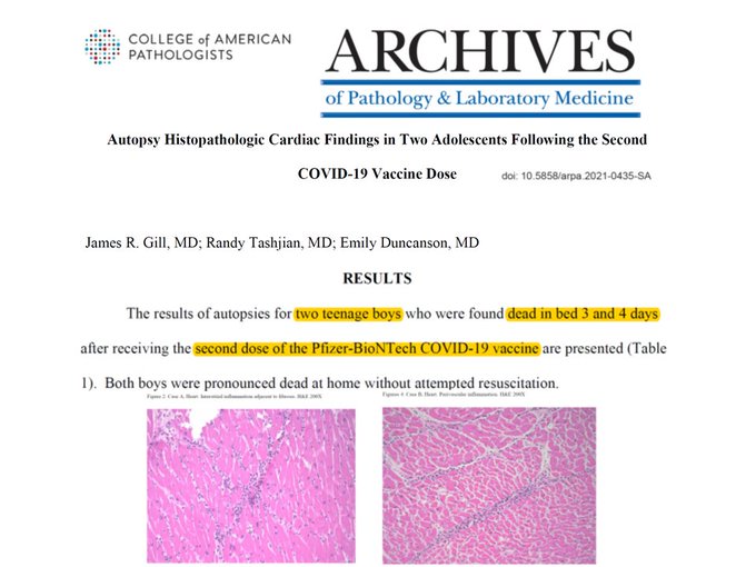 Second Dose of Pfizer COVID-19 Vaccine Takes Out 2 More Teen Boys FLonDiHXEAEoyW3?format=jpg&name=small