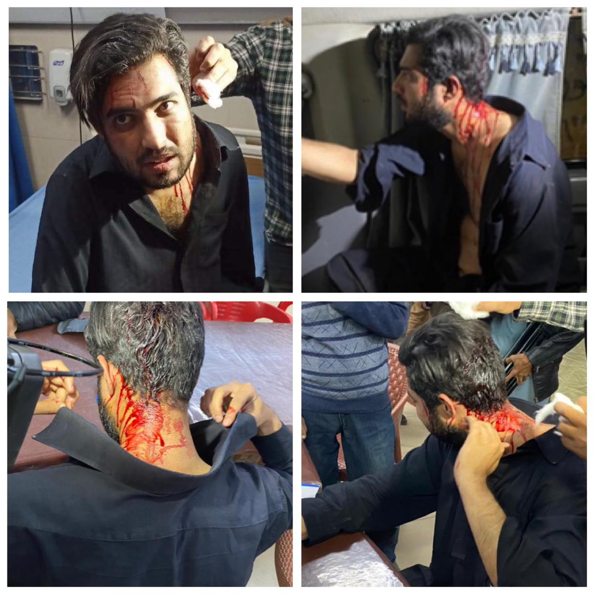 SaadatHaideri's tweet photo. It hurts to see this @iqrarulhassan . 
Salute to him for not caring about the fact that if all of it is worth it or not. Recover soon brother. 
اللہ تعالٰی اپنی امان میں رکھے - آمین
#iqrarulhassan https://t.co/wlUt12uckS https://t.co/JyP7ScKxJR