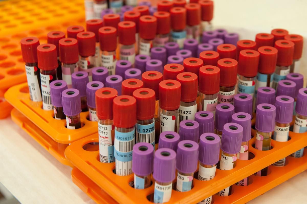 Ontario hospitals facing critical shortage of blood collection tubes