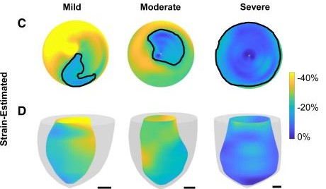 AJP-Heart and Circ (@ajpheartcirc) on Twitter photo 2-D echocardiographic akinetic length, #4Decho ultrasound, and strain provide effective in vivo methods for measuring fibrotic scarring after #MI ow.ly/zuPs50HVuTg
<a href="/uOttawaMed/">uOttawa | Faculté de médecine, Faculty of Medicine</a> <a href="/IUMedSchool/">IU School of Medicine</a> <a href="/PurdueEngineers/">Purdue Engineering</a> <a href="/mdann27/">Melissa Dann</a> <a href="/craig_goergen/">Craig Goergen</a> <a href="/Conner_C_Earl/">Conner Earl</a> <a href="/NatashaTrza/">Natasha Trzaskalski</a> 2-D echocardiographic akinetic length, #4Decho ultrasound, and strain provide effective in vivo methods for measuring fibrotic scarring after #MI ow.ly/zuPs50HVuTg
<a href="/uOttawaMed/">uOttawa | Faculté de médecine, Faculty of Medicine</a> <a href="/IUMedSchool/">IU School of Medicine</a> <a href="/PurdueEngineers/">Purdue Engineering</a> <a href="/mdann27/">Melissa Dann</a> <a href="/craig_goergen/">Craig Goergen</a> <a href="/Conner_C_Earl/">Conner Earl</a> <a href="/NatashaTrza/">Natasha Trzaskalski</a>