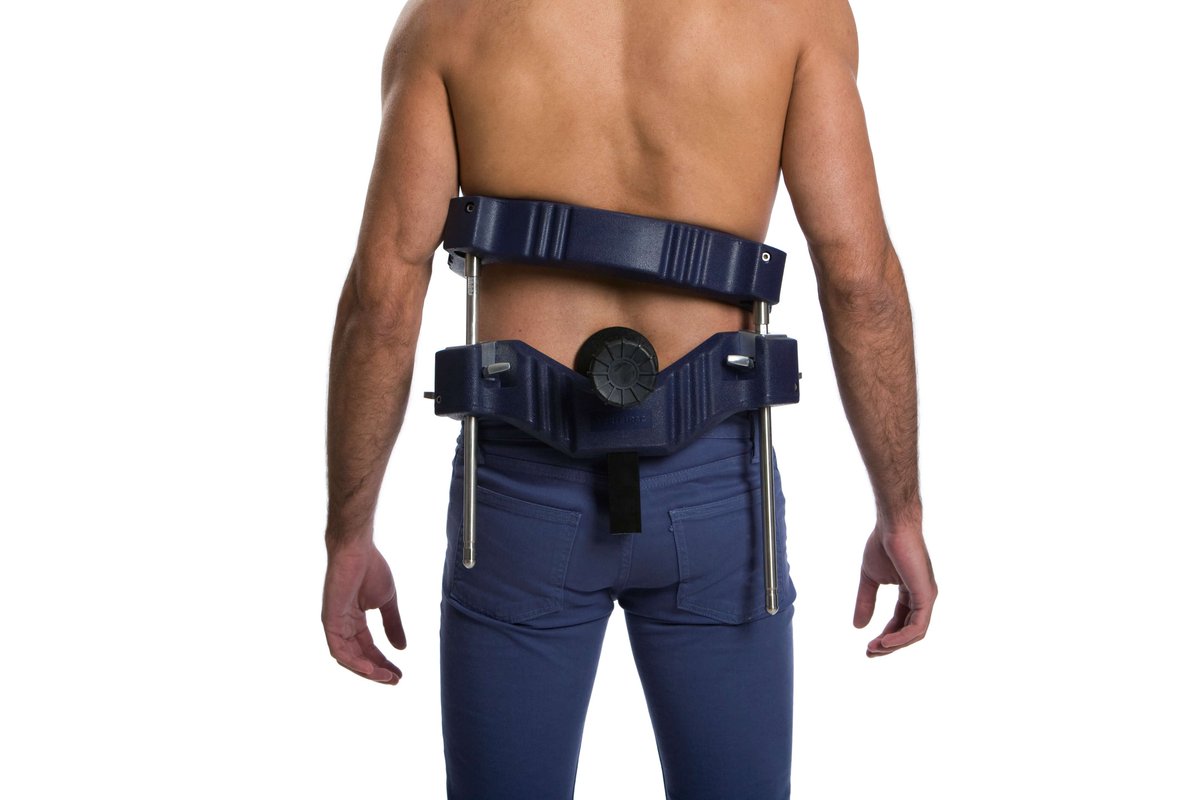 akshaykadam9699's tweet image. #SpinalDevices Registering a CAGR of 3.4%  2022 to 2027.
Report link- rb.gy/txbuau

Industry news-
SCS portfolio features the largest portfolio of full-body MRI conditional devices that combine therapy options for personalized pain relief.

#Industrydataanalytics #IDA