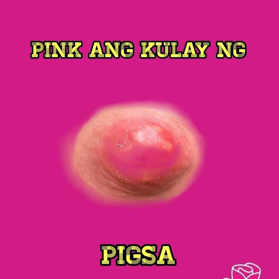 Hazelnut026's tweet photo. @mstraveler @heysaccharin_ @CattSushi @Rayo_delaVerdad @NAMercadoINQ Kawawa naman, di ba dapat sa sarili mo sinasabi yan? Kayo ang mahilig pumatol sa mga nakikita nyo, may makita lang kayong “Marcos” umiikot na agad mga pwet nyo. 

Nakakahiya kayo. Pwe! 
Kayo ang tunay na laman ng pigsa. Mga nana! https://t.co/V5P5Q0vClj