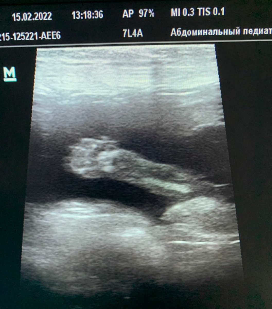 veterinastya's tweet photo. мама прислала свою сегодняшнюю находку на УЗИ кане-корсо. 
Видите-видите-видите, да? ❤️ https://t.co/Z5FclFLZ1a