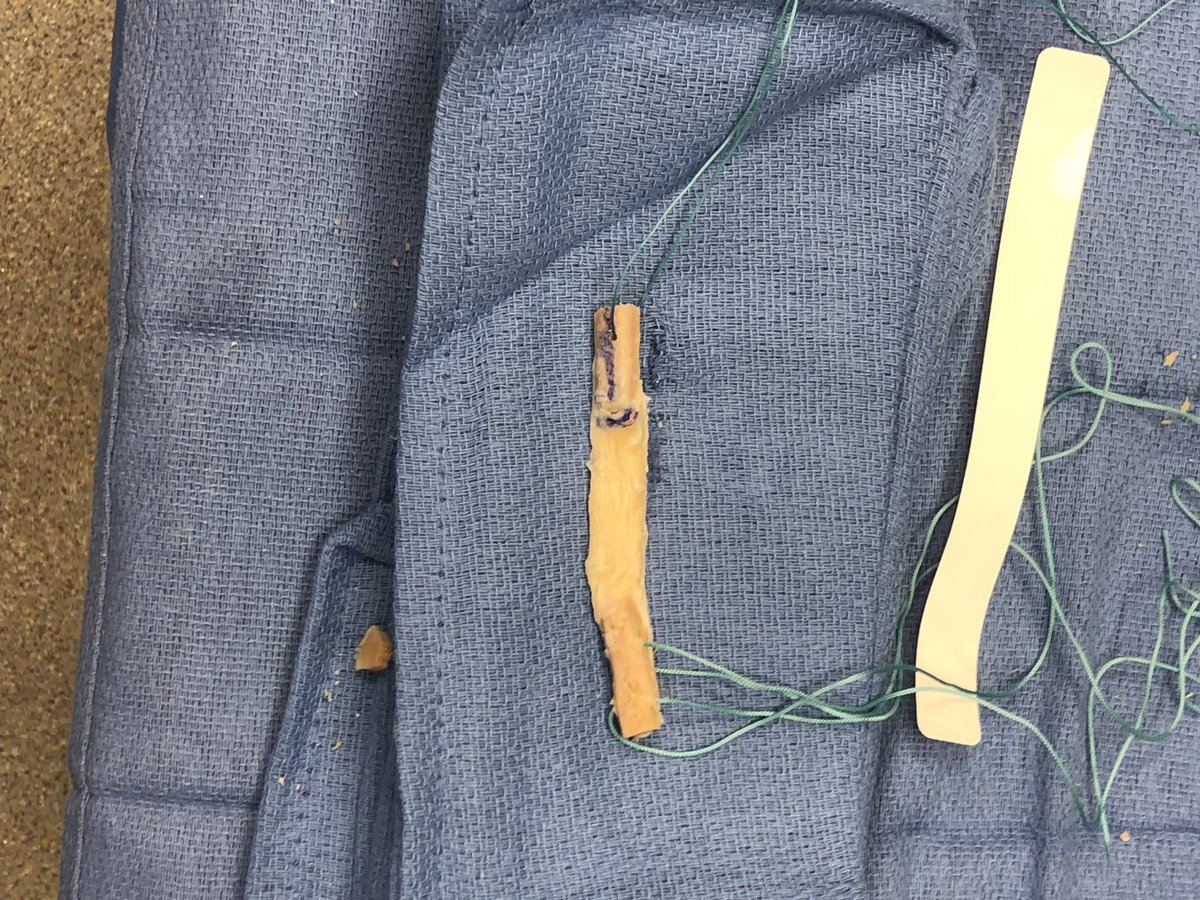 Nikhil N. Verma, MD tweet media