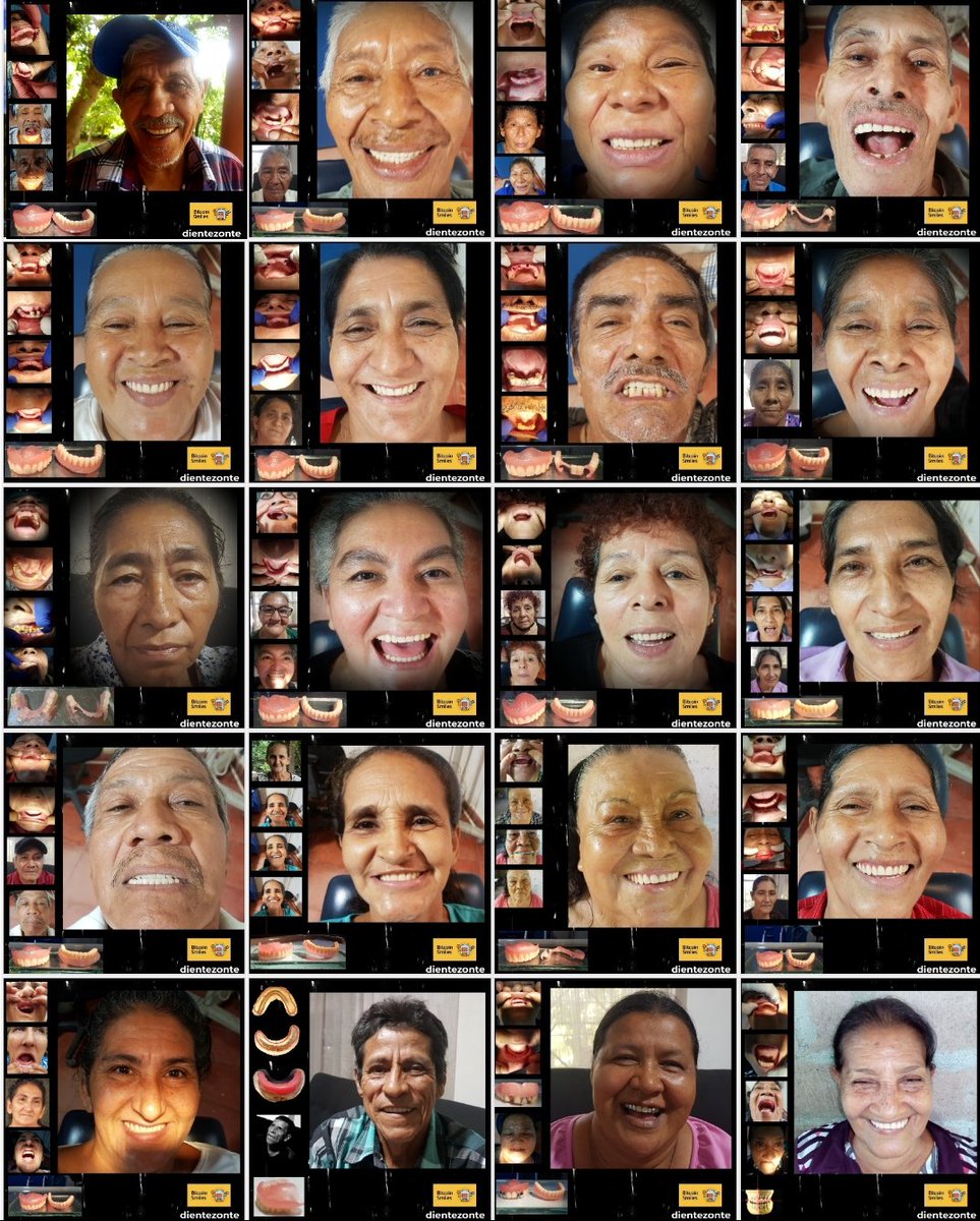 DienteZonte's tweet photo. So far, we have provided critical dental care and rehabilitated 20 patients through @BitcoinSmiles / these are their stories &amp; new smiles https://t.co/2t771FpzsJ 
¡We are just getting started! 🇸🇻 #Bitcoin #BitcoinFixesTeeth #ElZonte https://t.co/oSv6mdu3yG