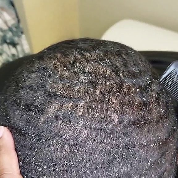 DermaSolutiongh's tweet photo. Anti-dandruff hair cream 

Treats dandruff and all scalp psoriasis

💯 effective

Ghc 40

DM or Call 0205773069 

Kindly Retweet 🙏 

#Dermasolution 
Abronye DC https://t.co/YW1RjD9ZKc