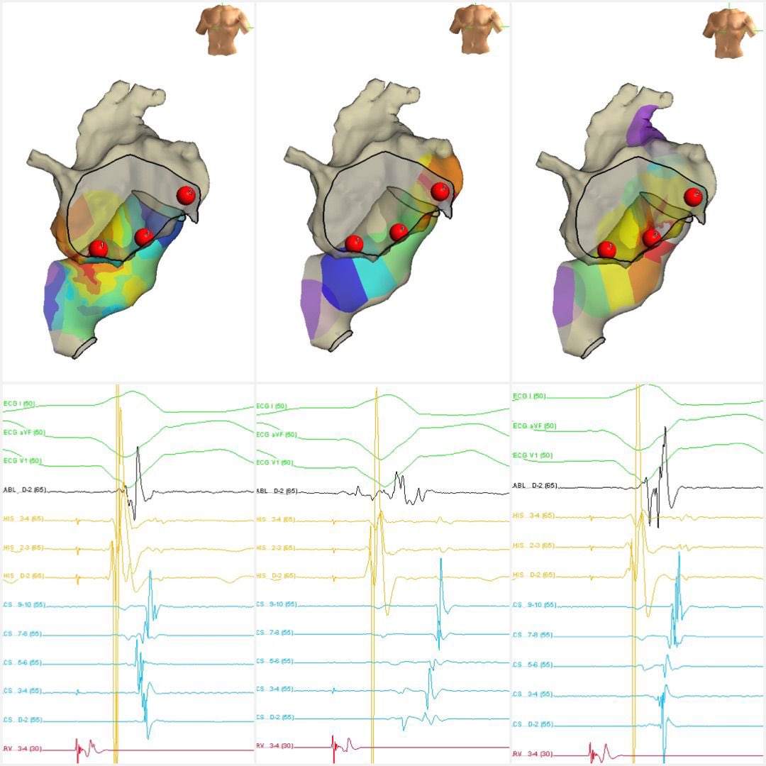 EP Mappers - Bay Area tweet media