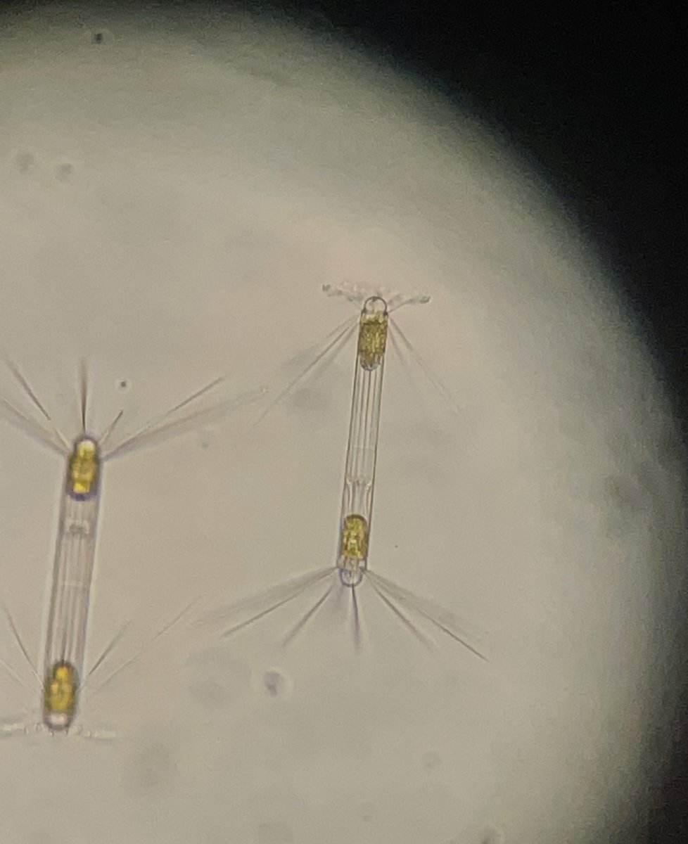 AJolesen's tweet photo. Who dominates the sea by the Antarctic peninsula? Not sea lions, humpbacks or krill. No, this tiny diatom. Corethron hystrix possibly? #diatoms @NHM_Denmark #diatomsoftheworld #phytoplankton #antarctica https://t.co/lfkq9v3A6U