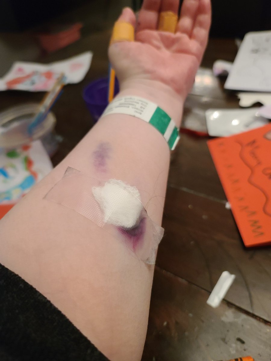 LibbyMbc's tweet photo. Total failure of an appointment today. They couldn't get it in 4 pokes. Apparently they can only try two each. Forced to rebook for Friday. Ugghhh #cancerproblems #cancerthoughts #biophosphates #cancer #terminal #metastaticbreastcancer https://t.co/AIx32nRBFC
