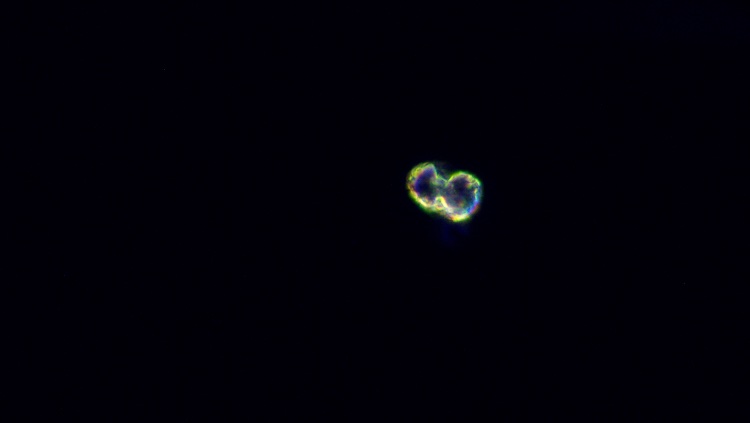 SarahRosenbloo3's tweet photo. Today in nephrology clinic, I learned that crystal casts exist. What did you learn today? #calciumoxalate #fancyurine #urinemicroscopy #lifelonglearning https://t.co/dARwdHcpV2
