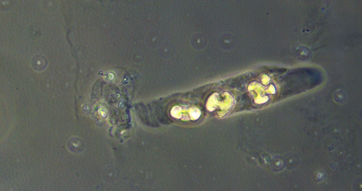 SarahRosenbloo3's tweet photo. Today in nephrology clinic, I learned that crystal casts exist. What did you learn today? #calciumoxalate #fancyurine #urinemicroscopy #lifelonglearning https://t.co/dARwdHcpV2