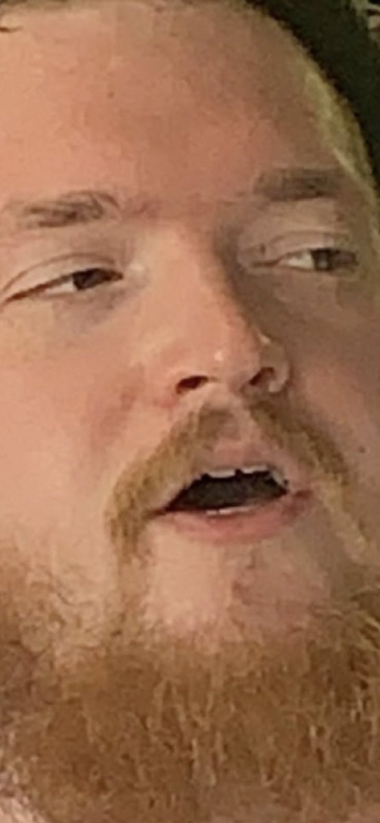 doctormudbutt's tweet photo. @dylanistiny https://t.co/EIntBA9w7p