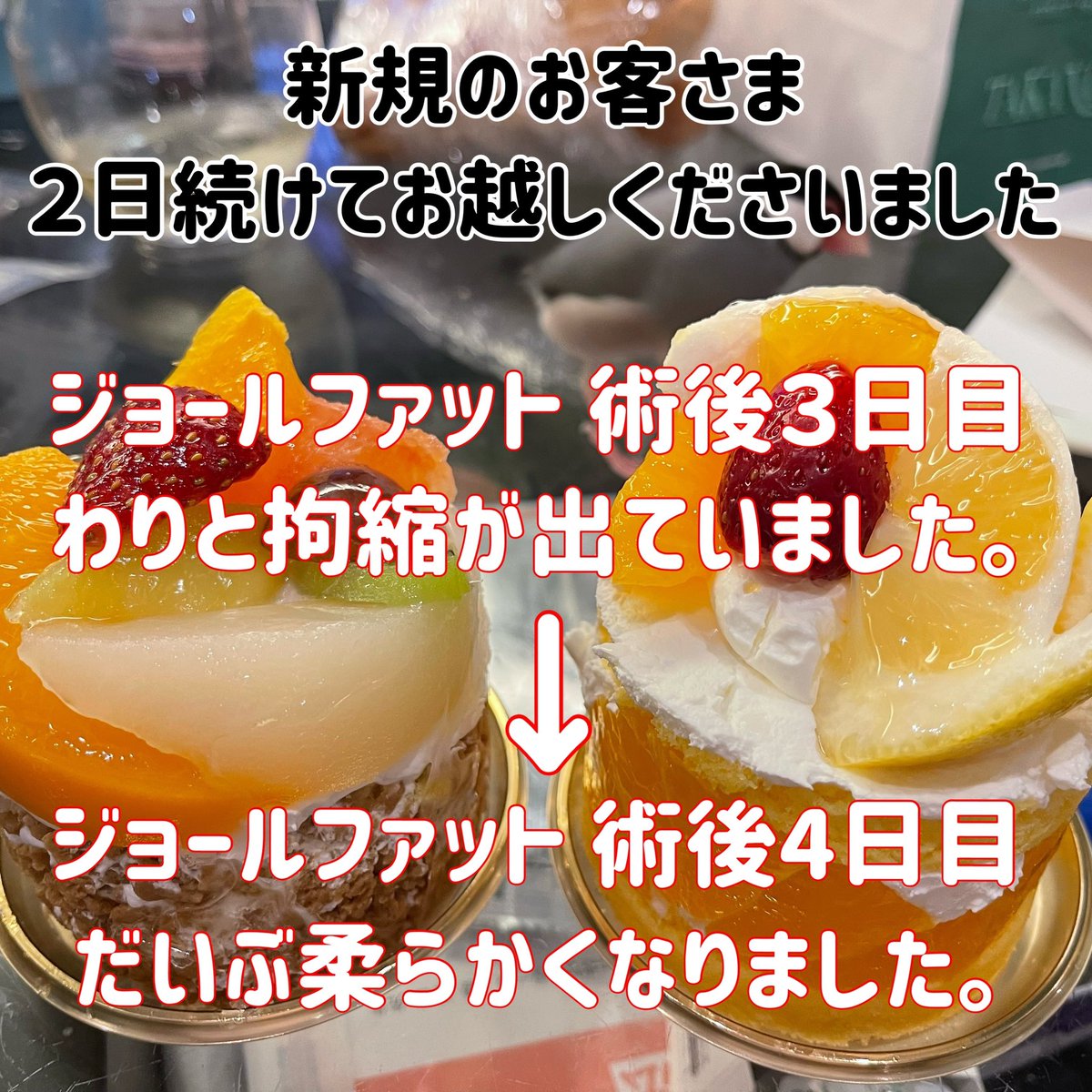 rainbowst78's tweet photo. #青山 #表参道 #外苑前
インディバサロン RainbowFactory78

https://t.co/kZOYSOKIn3

#脂肪吸引 #拘縮ケア #脂肪吸引後ケア #インディバ #脂肪吸引後にインディバ #インディバサロン #ダウンタイム
#ジョールファット #バッカルファット #脂肪注入 #豊胸 https://t.co/7NhyNWfx4T