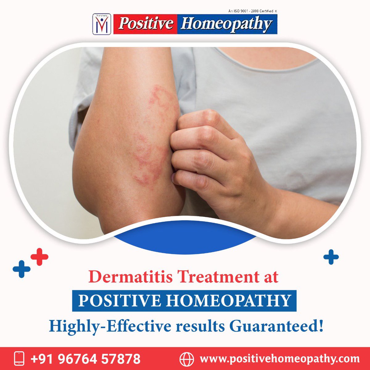 positivehomeo_'s tweet photo. Dermatitis is a chronic skin disorder that can significantly impact the quality of life of affected individuals. Positive Homeopathy can help you treat this very effectively. Call us and book your appointment: 9676457878. https://t.co/LN0izBJVPh #dermatitis #positivehomeopathy https://t.co/UcKjPr1bsV