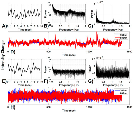Algorithms_MDPI's tweet image. #Daily_Share Highly Cited Articles #AlgorithmsMDPI
#AutomatedProcessing of #fNIRSData—A Visual Guide to the Pitfalls and Consequences
mdpi.com/1999-4893/11/5… #mdpialgorithms via @MDPIOpenAccess, @UCalgary, @harvardmed