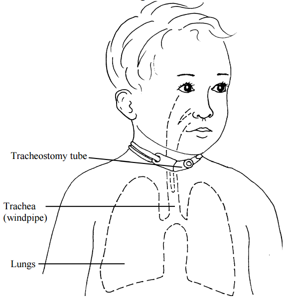 irisnancy97's tweet photo. #Laryngology is a branch of medicine that deals with #disorders, #diseases, and injuries of the #larynx, commonly known as the #voice box. 
Abstract submission link: https://t.co/gxGNkBWHFi https://t.co/M4Gb1Df4Ju