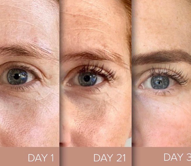 Some before and after pics whilst taking collagen capsules. #collagen  #skincare #beauty #antiaging #skin #vitaminc #collagendrink #glutathione  ##skincareroutine #pemutihbadan #healthyskin #serum #health #collagenpowder  #gluta #acne #pemutihwajah 