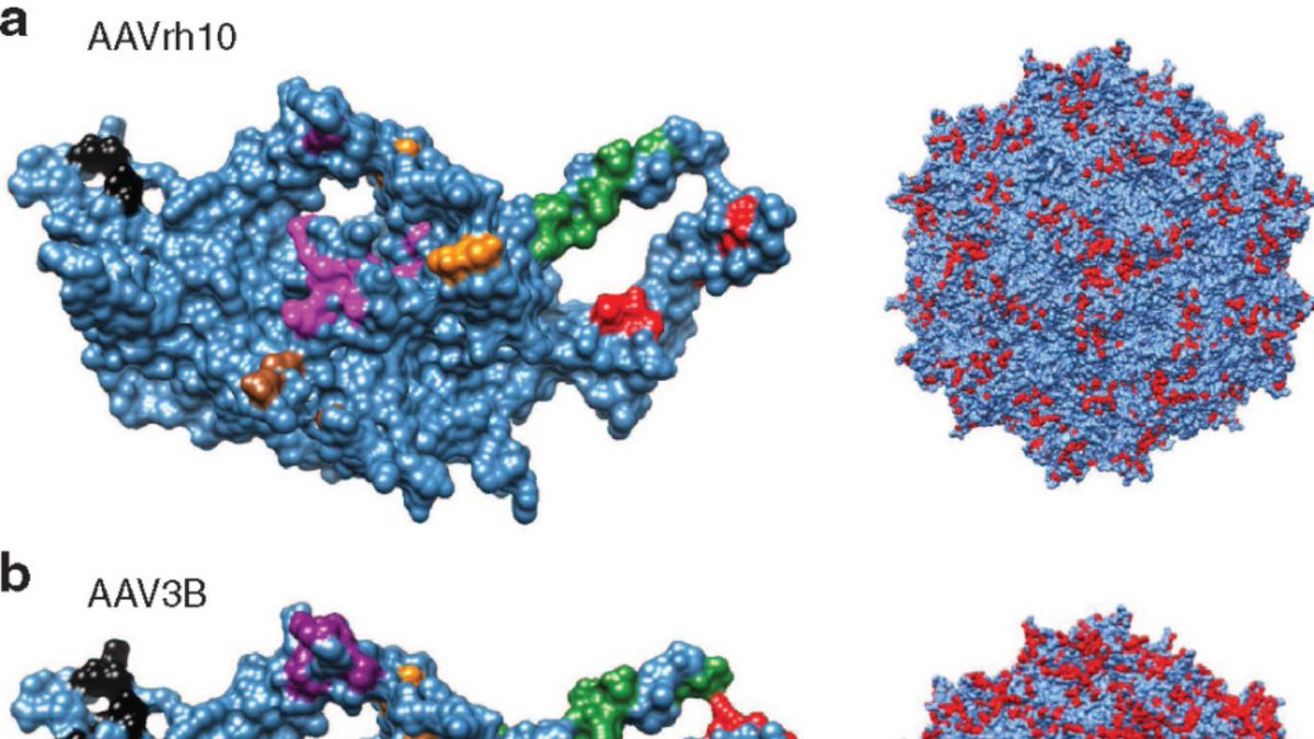 ASGCT (@asgctherapy) on Twitter photo Two babies received the first-ever #genetherapy for #TaySachs disease, and today at 1 p.m. (CT), you can hear from one of the developers of the therapy! ASGCT Member Miguel Sena-Esteves, PhD (<a href="/UMassChan/">UMass Chan Medical School</a>) is speaking at today's event, #AAV Vector Design: bit.ly/3qZybeV Two babies received the first-ever #genetherapy for #TaySachs disease, and today at 1 p.m. (CT), you can hear from one of the developers of the therapy! ASGCT Member Miguel Sena-Esteves, PhD (<a href="/UMassChan/">UMass Chan Medical School</a>) is speaking at today's event, #AAV Vector Design: bit.ly/3qZybeV