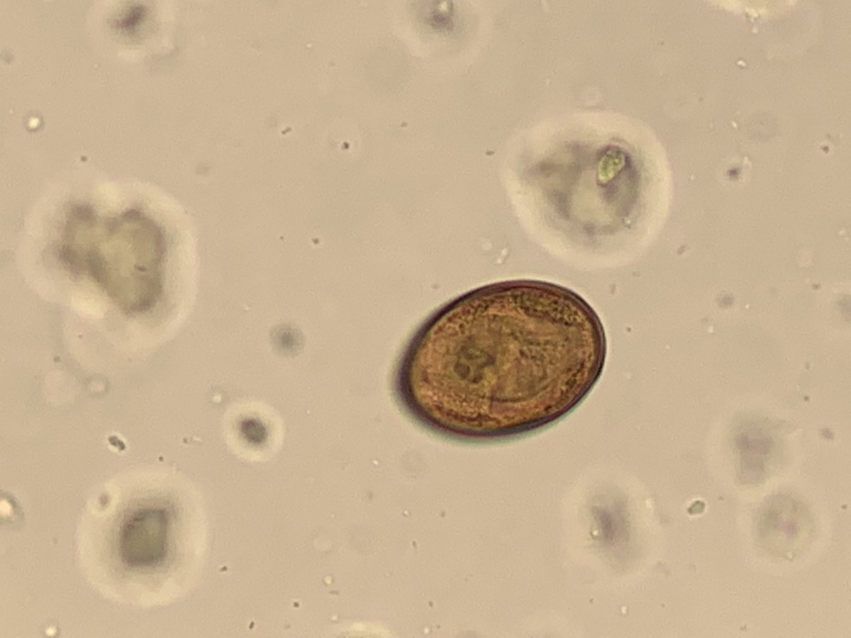 UTParasitePulse's tweet photo. From a cat fecal centrifugal flotation (can also be detected via fecal sedimentation).  The cat’s travel history showed recent move to Tennessee from Florida.  Egg measures 45x25 microns.  Note the operculum on one end.  What is your diagnosis? https://t.co/aCEOYOjEvm