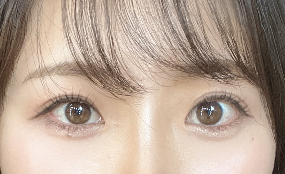 Moe 元々そこまで蒙古襞が強くないタイプだったんですが目の開きを良くする 目幅を広くする 垢抜けするために目頭切開をしてきました あとボルベラで涙袋ヒアルも一緒に打ってきました Dtが落ち着いたらビフォアフ載せようと思います 当分はメイク