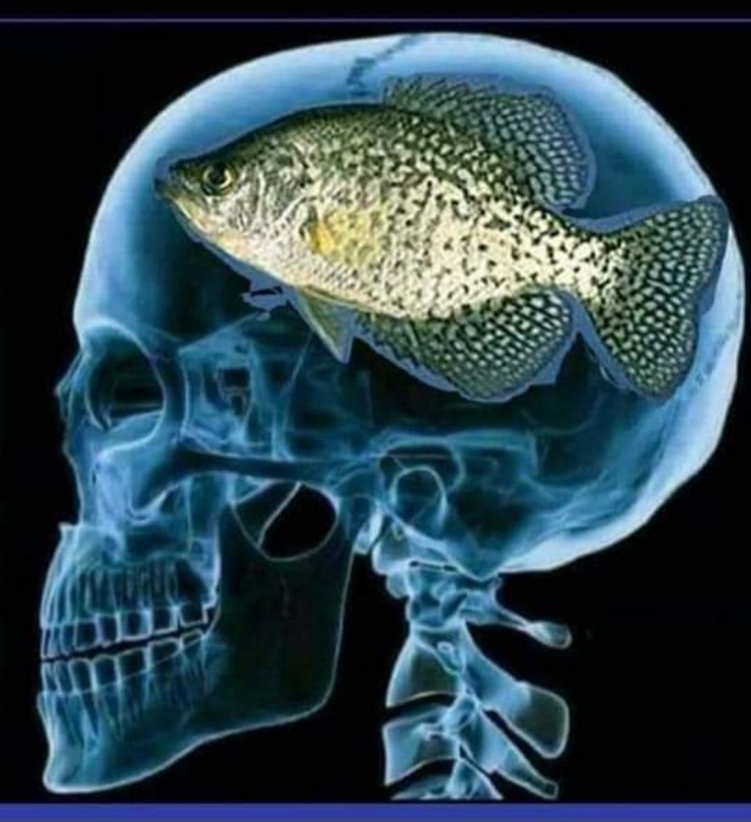 Bassreaperbaits's tweet image. Got a brain scan today