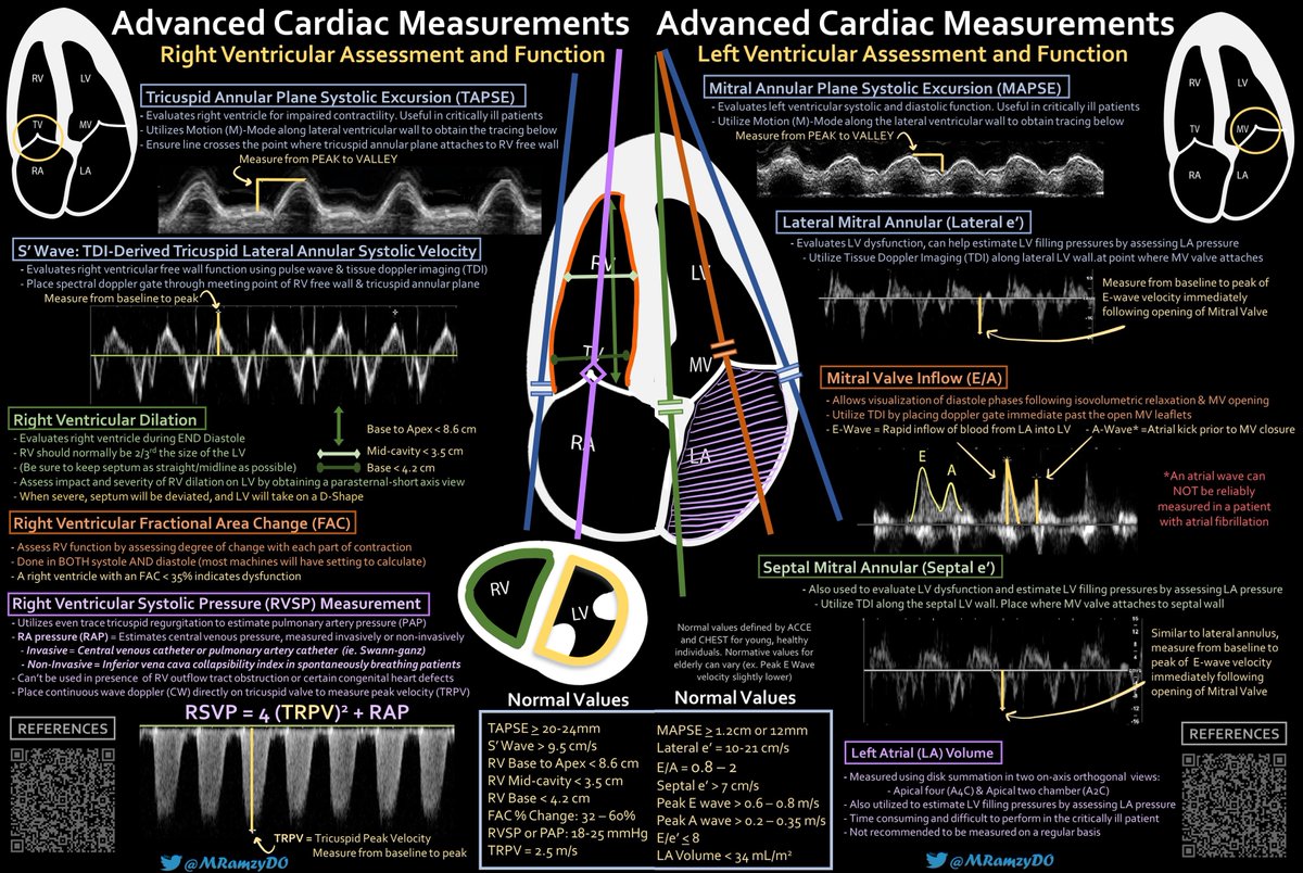 MRamzyDO's tweet photo. and finally both images COMBINED (3/3)!

🗒️This is not a comprehensive list of everything but rather a mobile-friendly resource that can help at bedside

#FOAMed #FOAMus

@PittCardiology @SAEMAEUS @aroradrn @CanadianKayMD @nephrothaniel @AmrFBakarat @MasriAhmadMD @PACCMUS @PACCM https://t.co/6xmmKYUUc4