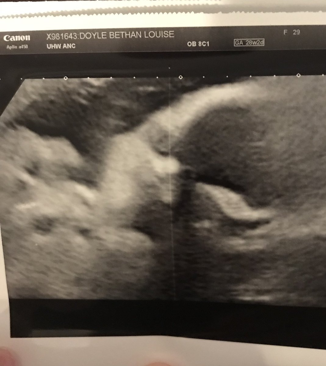 Bethaan92's tweet photo. We love you princess! Mammy and daddy can’t wait to meet you now!! Only 53 days till your due date!! #countdown #gettinguncomfortable #sheisworthit #cantwaittobeamamma 💖👶🏻🌏 https://t.co/rTTgrRreTd
