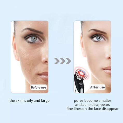 EyeEgyptian's tweet photo. Face Massager Skin Rejuvenation | Radio Mesotherapy LED Facial Lifting Beauty Vibration Wrinkle Removal
😀
https://t.co/pTHGBtCB1J
😀
#skinrejuvenation #skinrejuvenationclinic #skinrejuvenationtreatment #facemassager #facemassage #wrinkleremoval https://t.co/riQkArpxp6