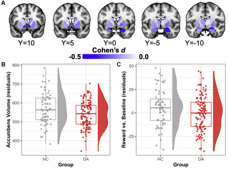 JAACAP's tweet image. #JAACAP study reports #depressed - #anxious adolescents exhibited structural and functional alterations in reward-related neural circuitry, which predicted depression symptom persistence over time. @theconnectome @ColumbiaPsych @CU_ChildPsych jaacap.org/article/S0890-…