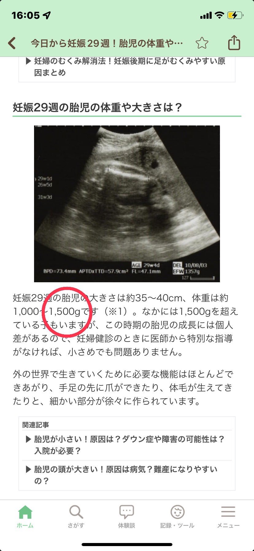 3m 38w5d どさんこ初マタ 個人差はあると思うけどアプリの平均体重より大きかった 笑 29w0dで1657gでした 予定より早く産んでも良いかもねって言われた 妊婦 妊娠29週 妊婦健診 T Co Tm25ondjl7 Twitter