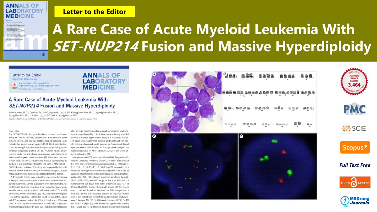 AnnLabMed's tweet photo. A Rare Case of Acute Myeloid Leukemia With SET-NUP214 Fusion and Massive Hyperdiploidy
📍https://t.co/3Bu31NmCng
#AnnLabMed 2019; 39(4) Jin Yeong Han, et al.
#Laboratory_Medicine #Acute_Myeloid_Leukemia #SETNUP214_Fusion #Massive_Hyperdiploidy https://t.co/ZhByfY5JKz