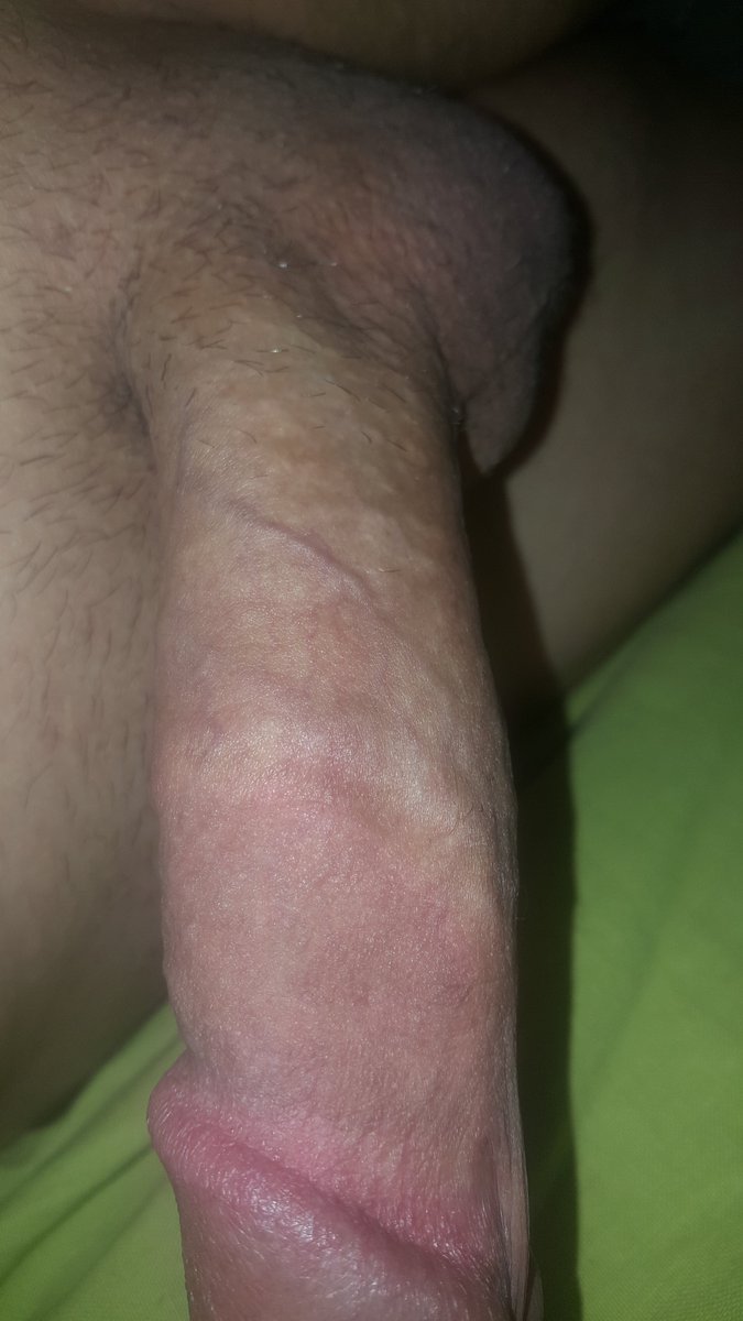 Sabah şekeri isteyen