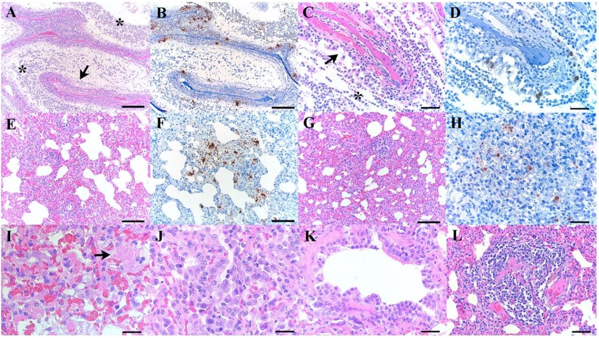 Our latest work shows #Omicron causes symptoms that are comparable to other variants. Debating against lower virulence of omicron &amp; highlighting the role of immunity for the less severe disease in humans. #COVID19 <a href="/SironenTarja/">Tarja Sironen</a> <a href="/SmuraTeemu/">Teemu Smura</a> <a href="/Olli_Vapalahti/">Olli_Vapalahti</a> 
biorxiv.org/content/10.110…
