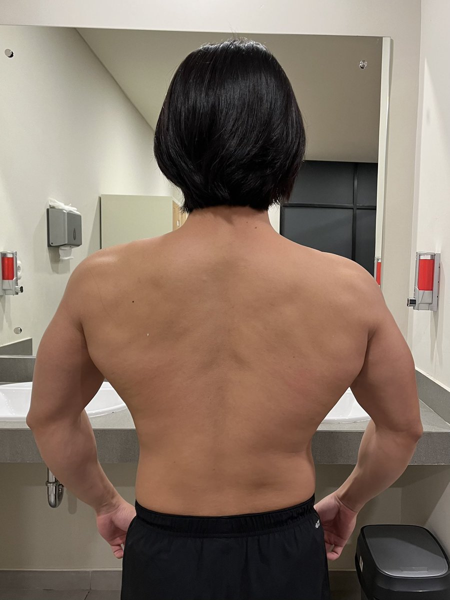 MooMeeSmile's tweet image. My back with scoliosis 🥲 #back #scoliosis #backexercise #gym #workout #fitness #sport