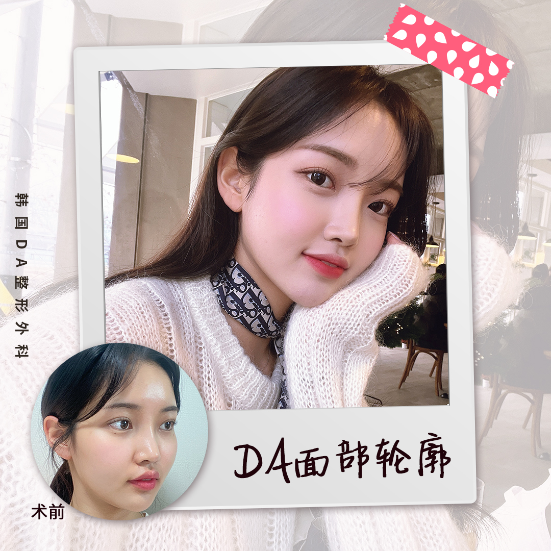 韩国整形外科 Twitter Search Twitter