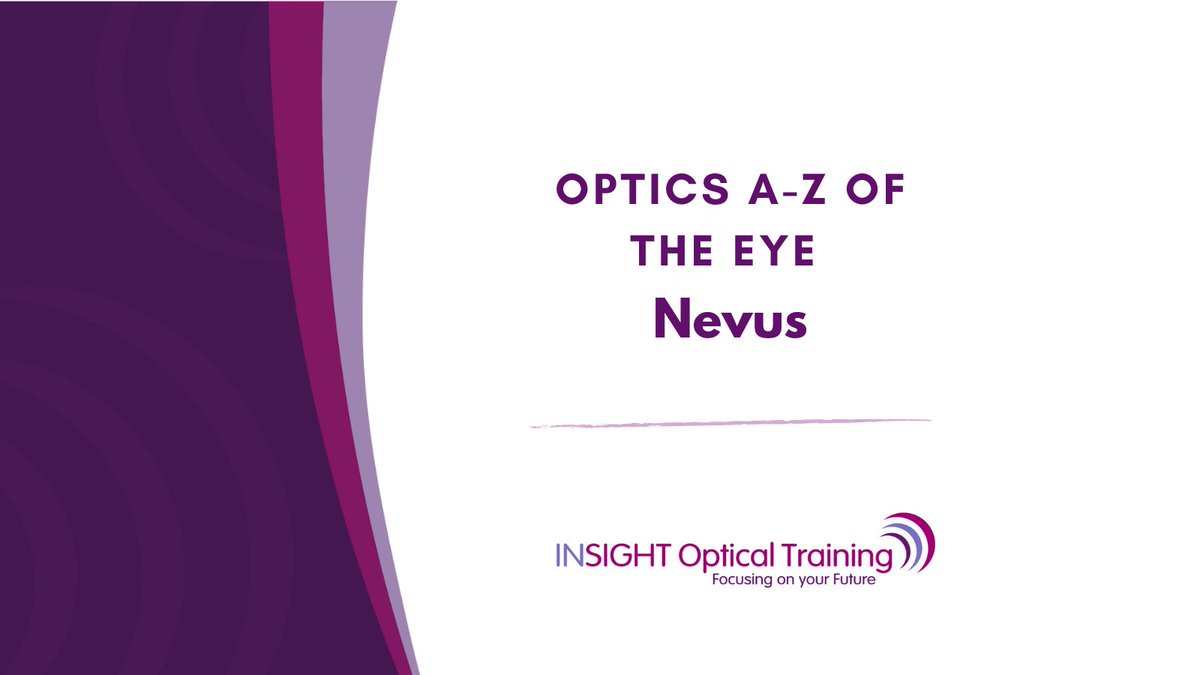 optical_insight's tweet photo. ποΈ What is a #nevus?
βΉοΈ A nevus is a common, colored growth on or in your eye. Sometimes called a freckle of the eye. A nevus (plural: nevi) can be in the front of your eye, around the iris, or under the retina at the back of the eye.
#insightoptical #eyefacts #opticalfacts https://t.co/aCD5UJVnZX
