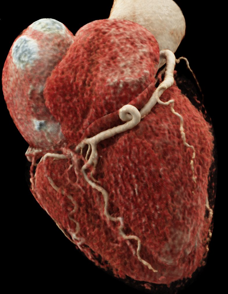 Manuel Barreiro-Perez tweet media