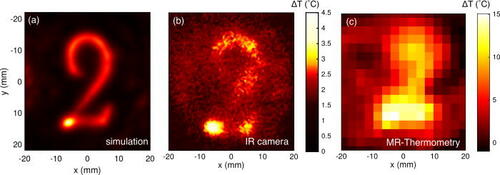 The paper "Thermal Holographic patterns for ultrasound hyperthermia" has been published by UMIL researchers in Applied Physics letters. Thermal patterns generation using 3D-printed #acousticholograms is demonstrated in this work. #ultrasound
doi.org/10.1063/5.0081…