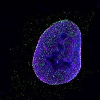 Vicky Sanz-Moreno (@vickysanzmoreno) on Twitter photo Please RT, we are offering a post-doctoral position to study how nuclear-cytoplasmic transport controls tumour dissemination and cancer cell communication with the micro-environment😀🤩🤩
<a href="/QMBCI/">Barts Cancer Institute (Queen Mary)</a> <a href="/CR_UK/">Cancer Research UK</a>
Follow up from super-talented <a href="/lkohlham/">lkohlham</a> PhD work!
qmul.ac.uk/jobs/vacancies… Please RT, we are offering a post-doctoral position to study how nuclear-cytoplasmic transport controls tumour dissemination and cancer cell communication with the micro-environment😀🤩🤩
<a href="/QMBCI/">Barts Cancer Institute (Queen Mary)</a> <a href="/CR_UK/">Cancer Research UK</a>
Follow up from super-talented <a href="/lkohlham/">lkohlham</a> PhD work!
qmul.ac.uk/jobs/vacancies…
