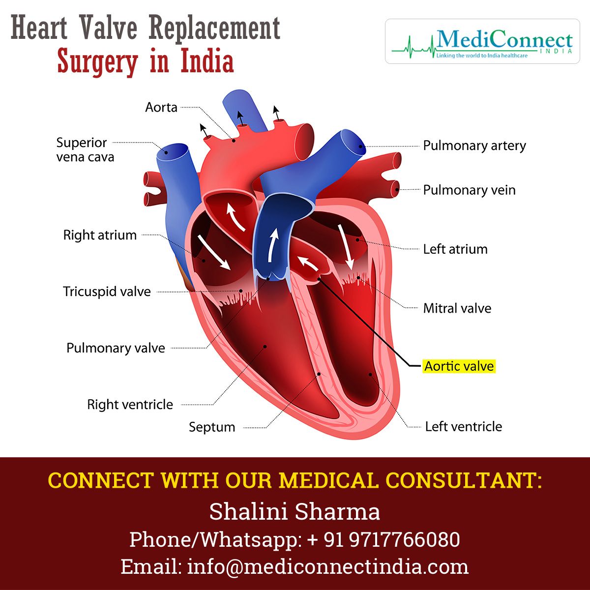 mediconnectind's tweet photo. Get the best Heart Valve Replacement Surgery in India from the reputed cardiothoracic surgeons. Keep in touch with Medi Connect India to unite with the best medical care. https://t.co/MQw8gYDSEb
Whatsapp📞: +91 9717766080  
📧Email us: info@mediconnectindia.com
#Surgery #Heart https://t.co/Wpo7dyiWRQ