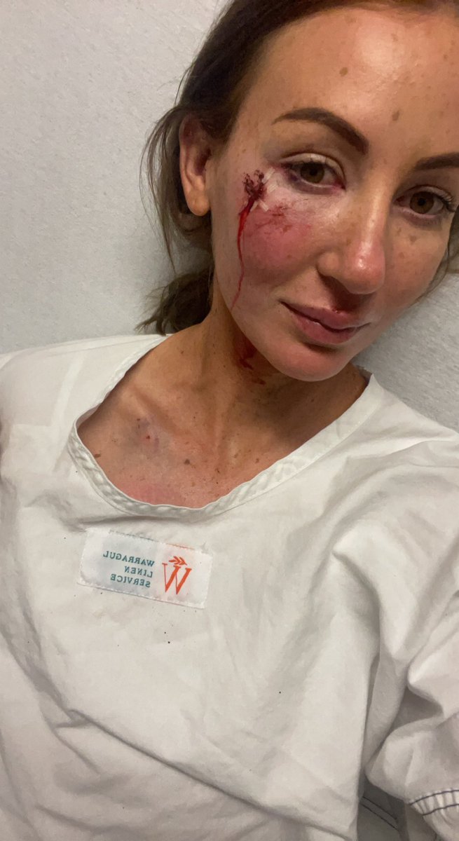 Feeling very lucky to be walking away from today’s incident just battered and bruised! Huge thanks to all that helped out and the fantastic medical staff at Sandown and The Alfred x <a href="/Racing/">Racing.com</a> <a href="/RSN927/">RSN Racing & Sport</a>