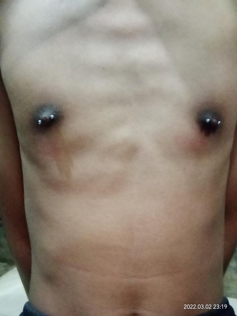_nippleeee tweet media