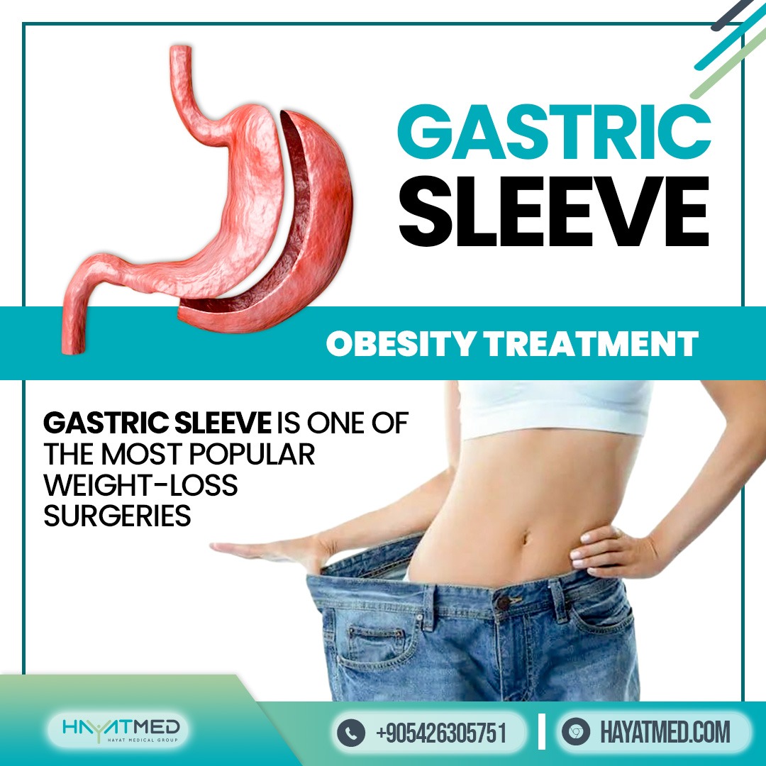 Hayatmedclinic's tweet photo. Change Your Life With #Hayatmedclinic 
our surgeons are a member of the international federation for the surgery of #obesity and metabolic disorders (ifso)

#gastricsleevesurgery #gastricsleevebeforeandafter #gastricsleevejourney #gastricsleeveuk #gastricsleevesuccess https://t.co/QHfFnCQXM6