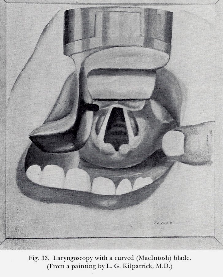MerlinLarsonMD1's tweet photo. An anesthesiologist will view this anatomical structure several thousand times in the course of a career.  It gets familiar...but when it is distorted by tumor or edema it is useful to know the separate anatomical structures (Image from Dornette, 1963; to be continued). https://t.co/iHkcy30VxF