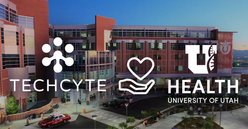 We're really excited to be working with the U of U to provide surgeons the data they need to make faster, better organ transplant decisions for patients, and donate $10,000 to the fund, which provides help for patients and families as they await and undergo transplant surgeries.