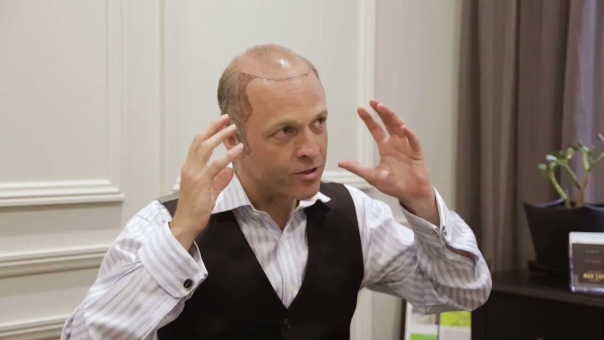 MartinickHair's tweet photo. #HairTransplant Consultation Part 4 - How Much Does a Hair Transplant Cost  https://t.co/073AKbWBqv https://t.co/KALDoPpkYW